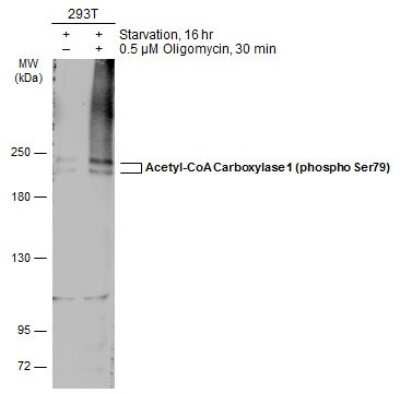 Western Blot: Acetyl-CoA Carboxylase alpha/ACACA [p Ser79] Antibody [NBP3-13324]